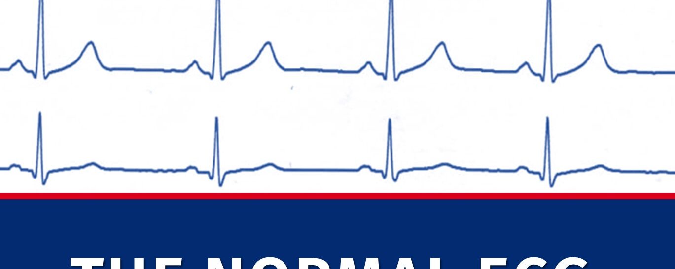 2. The normal ECG
