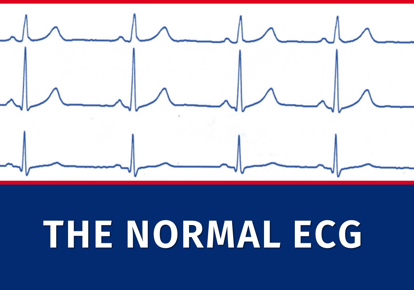 normal vs abnormal ecg