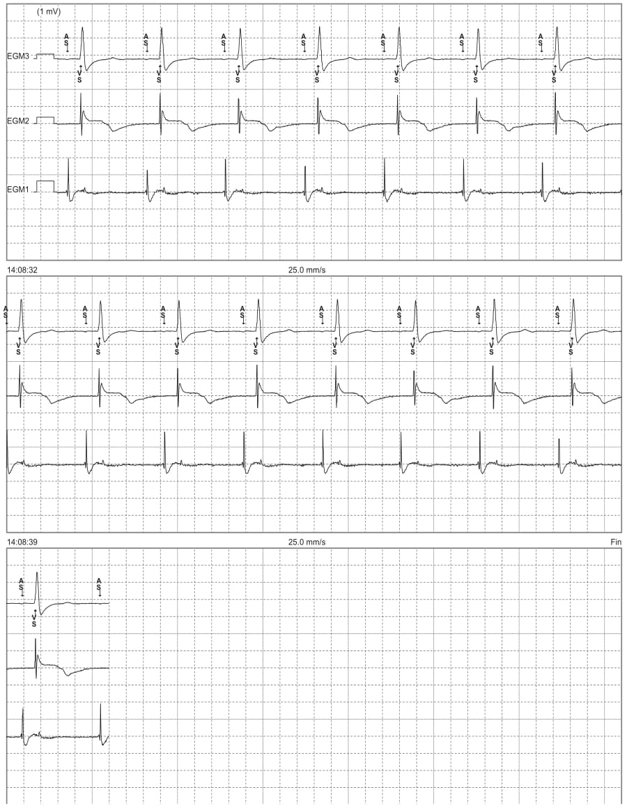 ECG 4.1 - MicroPort Academy