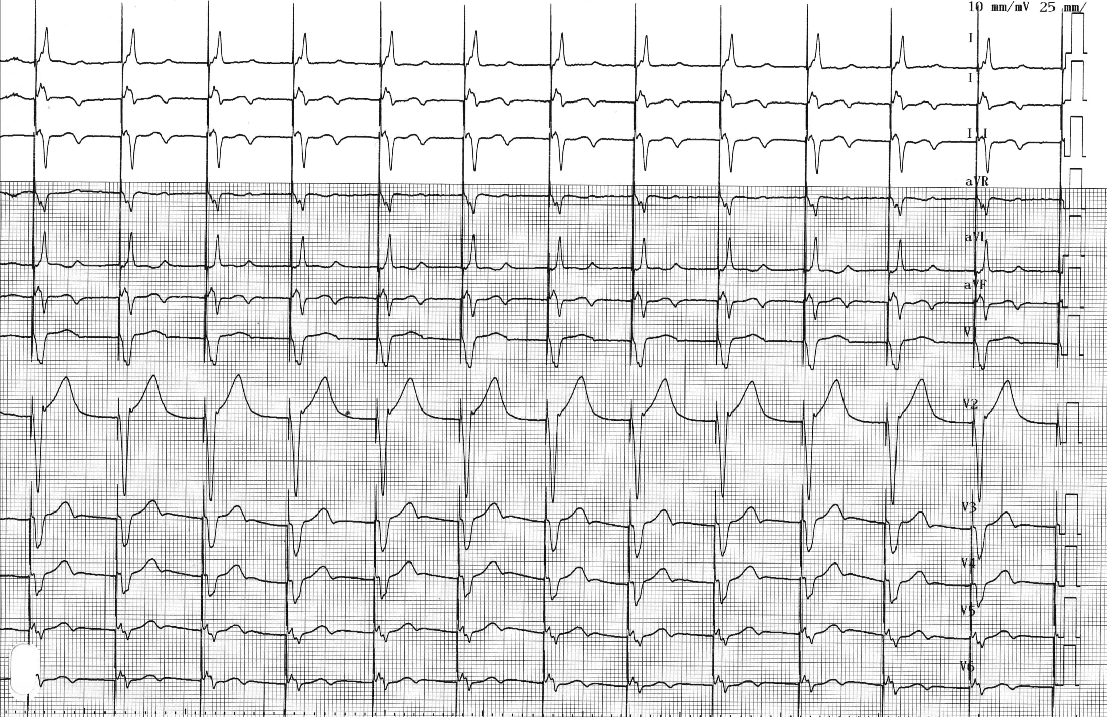 ECG 4.3 - MicroPort Academy