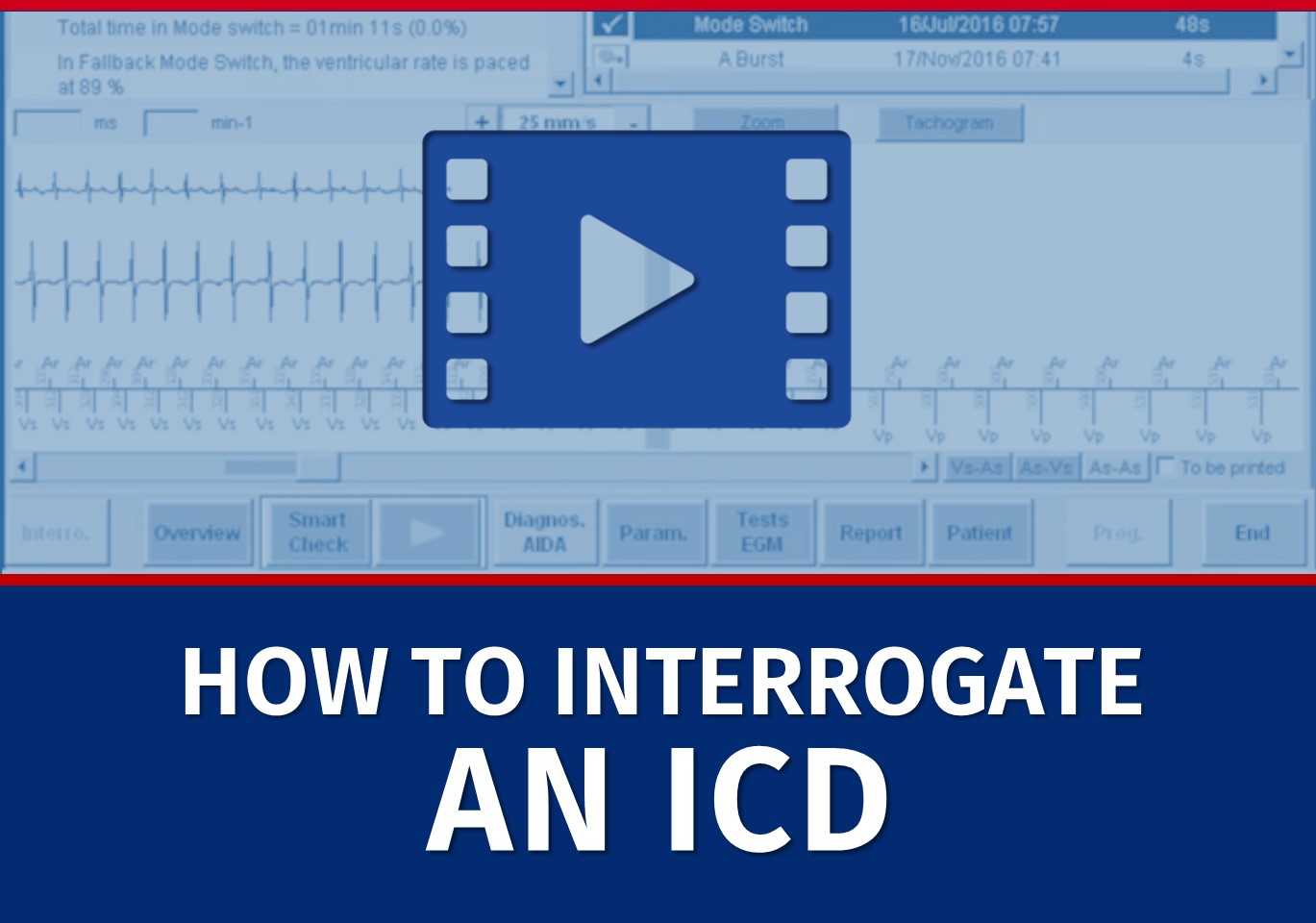 2-how-to-interrogate-an-icd-microport-academy