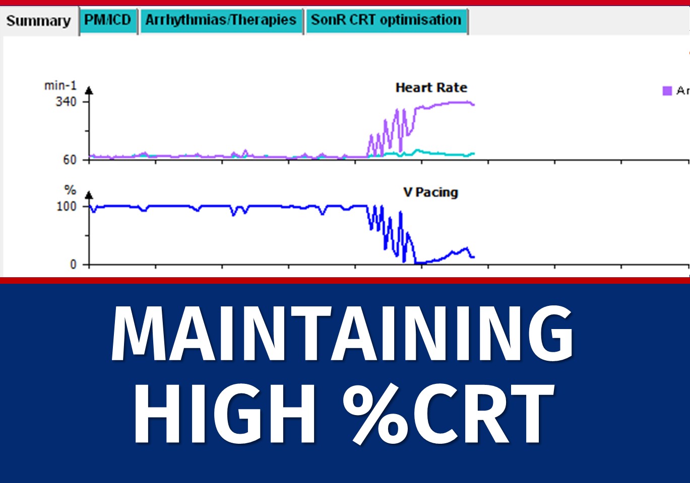 5-maintaining-high-crt-microport-academy