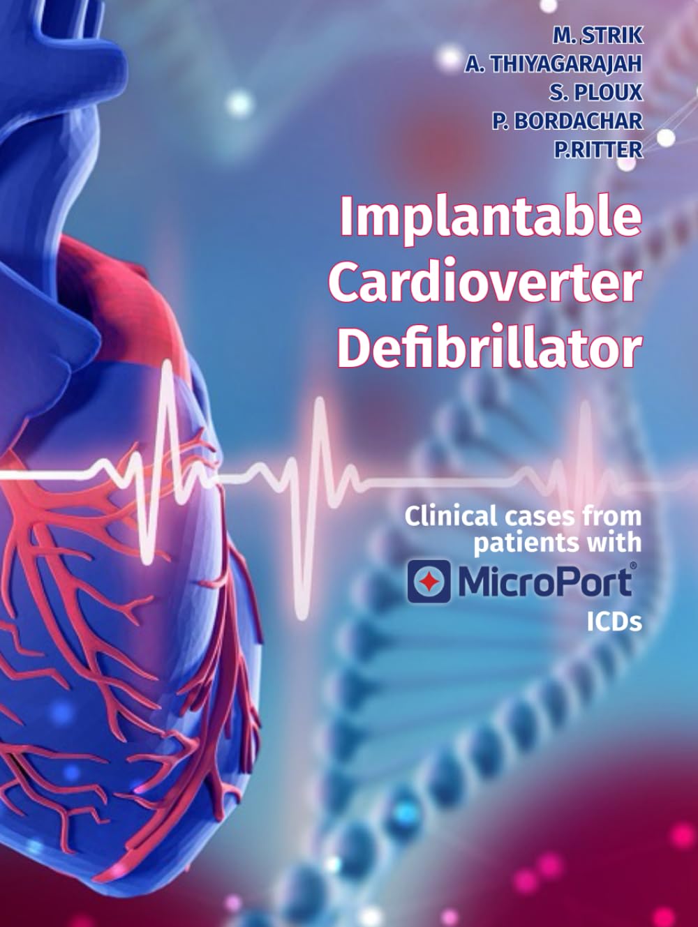 Implantable Cardioverter Defibrillator book cover - English edition